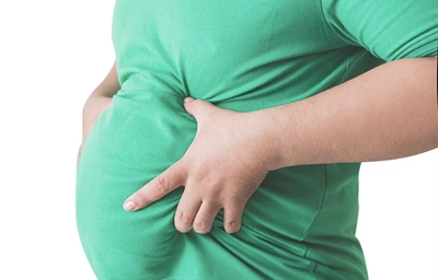 Obesity and Weight Loss