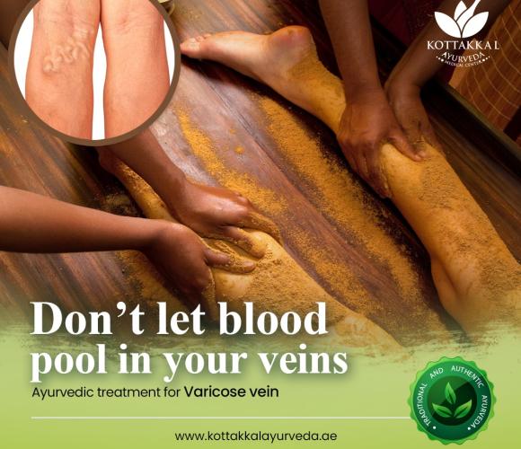  Varicose Veins Treatments